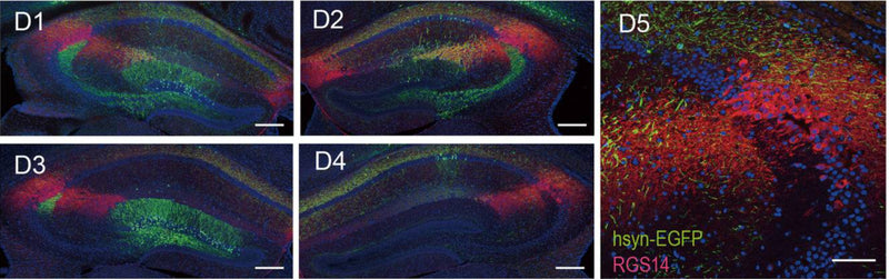 Representative confocal serial sections of hippocampus infected with AAV9/hSyn-Cre & AAV9/EF1α-DIO-EGFP (green) in dCA2 and stained with RGS14 (75-170, 1:500; red). D5 Magnified image of hSyn driven EGFP (green) and RGS14 (75-170, 1:500; red). Image showing no hSyn-EGFP cells and RGS14 overlapping, and EGFP expressed within CA2. Image from publication CC-BY-4.0. PMID:37303064