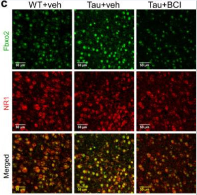 Representative fluorescence images of Fbxo2 (green) and NR1 (red; cat. 75-272, 1:500) fluorescence intensity in PFC slices from WT or Tau mice treated with Smyd3 inhibitor BCI121 or vehicle. Image from publication CC-BY-4.0. PMID:36609445