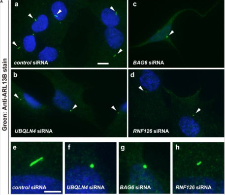 Primary cilium formation in hTERT-RPE1 cells treated with siRNA: control (a), UBQLN4 (b), BAG6 (c), and RNF126 (d). At 72 h after transfection, hTERT-RPE1 cells were serum-starved for 24 h to trigger ciliogenesis, and the distribution of ARL13B, a marker for primary cilia, was observed (cat. 75-287 green). Control cells grew primary cilia (a), whereas those treated with knockdown of UBQLN4 (b), BAG6 (c), and RNF126 (d) failed to grow cilia. Image from publication CC-BY-4.0. PMID:37182096