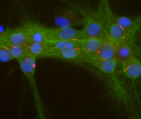 Immunostaining of cultured rat neurons and glia showing strong staining of neuronal cilia using our anti-adenylate cyclase III antibody (cat. 85-AC3, 1:500, red) and axonal and dendritic staining of alpha II spectrin (cat. 98-A2SM,1:500, green) revealing the submembranous cytoskeleton and DNA (blue).