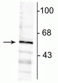 Western blot of rat cortical lysate showing specific immunolabeling of the ~57 kDa α6-subunit of the GABAA-R.