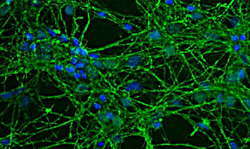 Immunofluorescence of rat neuron/glial culture labeling GAP43 protein (cat. 875-GAP43, 1:2000, green) expressed in the axonal membrane and synapses of neuronal cells. DAPI (blue) was used for nuclear staining.
