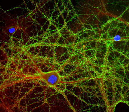 Immunolabeling of mixed neuron and glial cultures with anti-GAP43 (cat. 875-GAP43, 1:2000, green), alpha II spectrin (cat. 99-A2SR, 1:1000, red) and nuclear staining with DAPI (blue). The anti-GAP43 labels protein expressed in the axonal membrane and synapses of neuronal cells. The Anti-αII-Spectrin labels the submembraneous cytoskeleton of axons and dendrites.