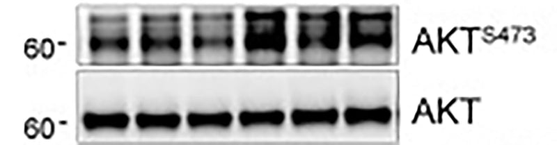 Western blot image of HEK293 cells treated with 100 nM insulin for 15, 30, 60, and 120 minutes measuring AKT activation between phosphorylated and total AKT protein levels. (Cat No AM1011, 1:1000). CC-BY-4.0 PMID: 37108445