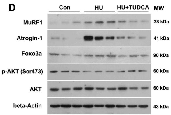 Western blot analysis of MuRF1 (cat. MP3401), Atrogin-1 (cat. AP2041), FoxO3a, p-AKT (Ser473), and total AKT in the soleus muscle of control, HU, and HU+TUDCA mice. Image from publication CC-BY-4.0. PMID: 37525907