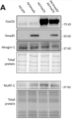 Representative Western blots for Atrogin-1 (cat. AP2041, 1:1000) in rat ASM cells that were infected for 24 h with Ad-GFP, Ad-Smad3, Ad-FoxO3, or Ad-Smad3/Ad-FoxO3. Image from publication CC-BY-4.0. PMID: 37693008