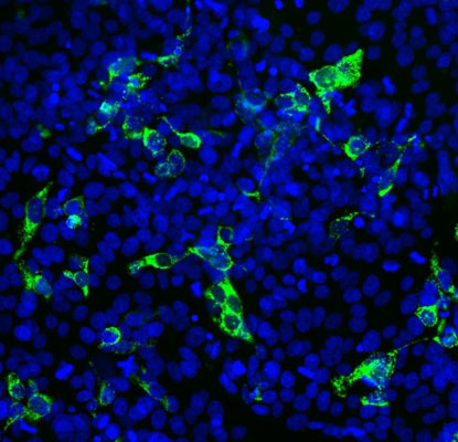 Immunofluorescence of SARS-CoV-2 transfected HEK293 cells showing specific staining of SARS-CoV-2 in green. Nuclei are visualized in blue with DAPI.