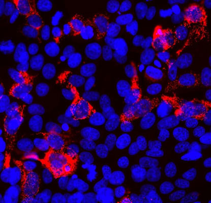 Immunofluorescence of SARS-CoV-2 transfected HEK293 cells showing specific staining of SARS-CoV-2 in red. Nuclei are visualized in blue with DAPI.