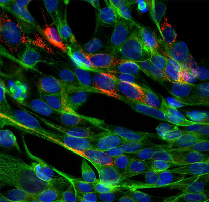 Immunofluorescence of SARS-CoV-2 transfected HEK293 cells showing specific staining of SARS-CoV-2 in red. Nuclei are visualized in blue with DAPI and B-tubulin co-staining is shown in green.