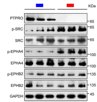 Immunoblotting of PTPRO, p-SRC, SRC, p-EPHA4 (cat. EP2731, 1:1000), EPHA4, p-EPHB2, and EPHB2 in Ptpro+/+ and Ptpro–/– mice hippocampi under Chemotherapy-related cognitive impairment (CRCI). Image from publication CC-BY-4.0. PMID: 37485875