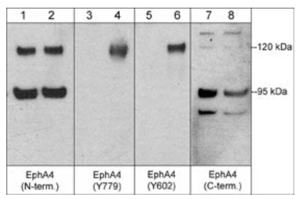 Western blot analysis of human umbilical vein endothelial cells untreated (lanes 1, 3, 5, & 7) or treated with pervanadate (1 mM) for 30 min. (lanes 2, 4, 6, & 8). The blot was probed with anti-EphA4 (N-terminal region) (lanes 1 & 2), anti-EphA4 (Tyr-779) (lanes 3 & 4), anti-EphA4 (Tyr-602) (lanes 5 & 6), or anti-EphA4 (C-terminal region) (lanes 7 & 8).