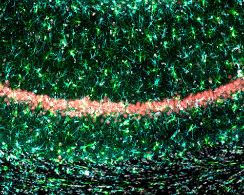 Immunostaining of rat hippocampus CA1 region identifying NeuN (red), IBA1 (green), and GFAP (Cat GFAP, 1:4000, cyan). The 30 um free-floating PFA-fixed tissue was embedded with Prolong Diamond with DAPI (grey). 10x image. Image kindly provided by Tim D. Ostrowski, A.T. Still Univ., Kirksville, MO.