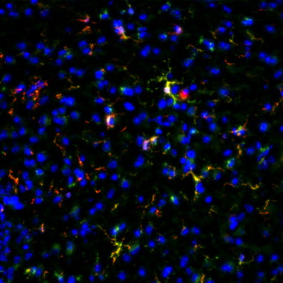 Immunostaining of CX3CR1-Cre mouse hypothalamus showing specific detection of GFP (cat. GFP, green) and IBA1 (red). Nuclei are labeled with DAPI (blue). Image kindly provided by Karmen Ma, NIDDK – National Institutes of Health.