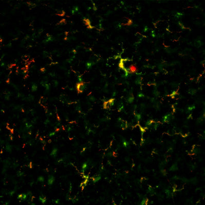 Immunostaining of CX3CR1-Cre mouse hypothalamus showing specific detection of GFP (cat. GFP, green) and IBA1 (red). Image kindly provided by Karmen Ma, NIDDK – National Institutes of Health.