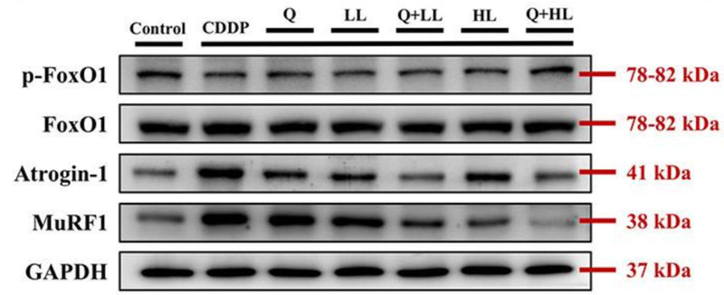 The individual and combined effect of quercetin (Q) and low dose (LL) or high dose (HL) of leucine on relative protein expression of p-FoxO1/FoxO1, Atrogin-1 (cat. AP2041), and MuRF1 (cat. MP3401) in the gastrocnemius muscle in BALB/c mice exposed to cisplatin (CDDP). Image from publication CC-BY-4.0. PMID: 37699022