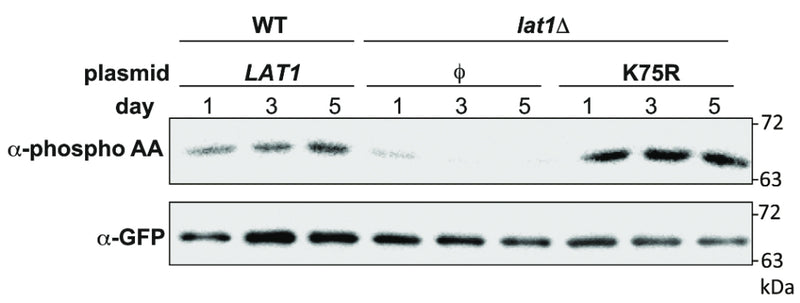 Mutant lat1Δ cells (PKY2298) expressing the indicated plasmids, as well as Mdh1-GFP, were grown in SL medium for the indicated amounts of time, and protein extracts were generated and immunoprecipitated with  with α-GFP antibody. Phosphorylation of Mdh1-GFP was detected using α-phosphoamino acid antibody (cat. PM3801), and total GFP signal in the immunoprecipitate was observed by immunoblotting with the α-GFP antibody. ϕ denotes an empty vector. Image from publication CC-BY-4.0. PMID: 37454238