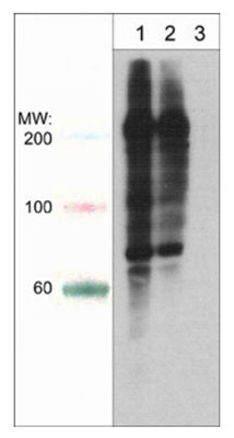 Western blot analysis of A431 cells treated with calyculin A (100 nM) for 30 min (lane 1 and 2) then treated with lambda phosphatase (lane 3). The blot was probed with anti-Phosphoserine/threonine mouse monoclonal at 1:250 (lane 1) or 1:1000 (lanes 2 & 3)