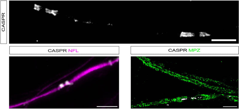 In mature myelinating cultures, SCs CASPR (cat.75-001, 1:500; white) can be detected in the characteristic staining pattern marking paranodes. Scale bar 5 μm. Paranodal CASPR co-localised on NFL-labelled axons (magenta). Scale bar: 5 μm. When colabelling with MPZ (cat. PZO, 1:500; green), CASPR is localised to paranodal loops adjacent to a node of Ranvier. Scale bar: 10 μm. Image from publication CC-BY-4.0. PMID:37642648