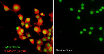 Immunocytochemical labeling of nSMase2 in aldehyde-fixed and NP-40-permeabilized differentiated PC12 cells. The cells were labeled with rabbit polyclonal anti-nSMase2 (SP4061) antibody in the absence (Left) or presence (Right) of blocking peptide (SX4065). The antibody was detected using appropriate secondary antibody conjugated to DyLight® 594. The cells were counterstained with Sytox green to label nuclei.