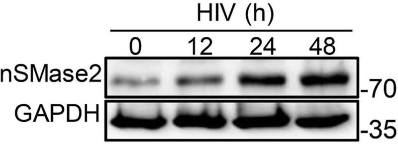 Representative immunoblots showing expression of nSMase2 (cat. SP4061, 1:1000) at the indicated timepoints (0 to 48 h) following HIVRF infection of H9 cells. Image from publication CC-BY-4.0. PMID: 37406092