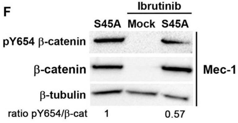 An analysis of the phosphorylation of β-catenin at Y654 in Mec-1 cells transfected with the S45A mutant or an empty plasmid (mock). Where indicated, the cells were pretreated or not with ibrutinib (100 nM) for 1 h. The Western blot is representative of 3 independent experiments. Image from publication CC-BY-4.0. PMID: 38139452