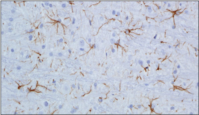 Immunohistochemistry (Formalin-fixed paraffin-embedded) staining of adult mouse brainstem showing labeling of astrocytes with chicken anti-GFAP antibody (catalog no. GFAP) at a dilution of 1:500.