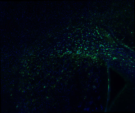 Immunostaining of adult mouse brain section fixed in 4% paraformaldehyde and preserved in cryoprotectant showing specific detection of GFAP (cat. GFAP, 1:500; red) in astrocytes around the corpus calosum. Nuclei stained with DAPI (blue). Background stain was attenuated with TrueVIEW. Image kindly provided by Ifeoluwa (Hiphy) Awogbindin of the Tremblay Lab, Division of Medical Sciences, University of Victoria, Canada.