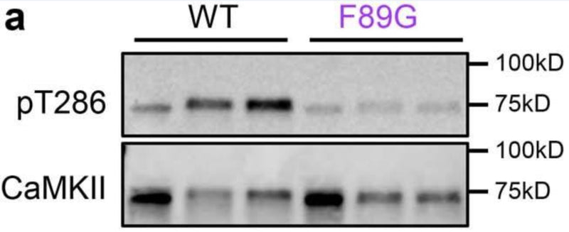 Representative immunoblot and quantification of in vitro kinase reactions at 30 °C in 1 mM ATP measuring CaMKIIα WT and F89G phosphorylation of T286 (cat. p1005-286, 1:2500). Image from publication CC-BY-4.0. PMID: 37648853