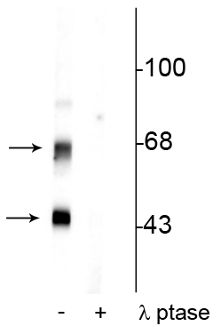Western blot of rat brain lysate showing specific immunolabeling of the ~50 kDa α- and the ~60 kDa β-CaM Kinase II phosphorylated at Thr306 in the first lane (-). Phosphospecificity is shown in the second lane (+) where the immunolabeling is completely eliminated by lysate treatment with lambda phosphatase (λ-Ptase, 800 units/1mg protein for 30 minutes). 