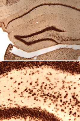 Immunolabeling of mouse hippocampal section labeled with anti-phospho-ser133 CREB (cat. p1010-133, DAB, 1:100, top). The image on the bottom is a magnification of the dentate gyrus section of the hippocampus. These images were kindly provided by Dr. Anton Reiner, Univ. of Tennessee Health Science Center (Memphis, TN).