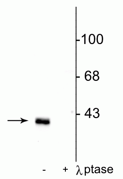 Western blot of rat striatal lysate showing specific immunolabeling of the ~32 kDa DARPP-32 phosphorylated at Thr75 in the first lane (-). Phosphospecificity is shown in the second lane (+) where immunolabeling is completely eliminated by blot treatment with lambda phosphatase (λ-Ptase, 1200 units for 30 min). 