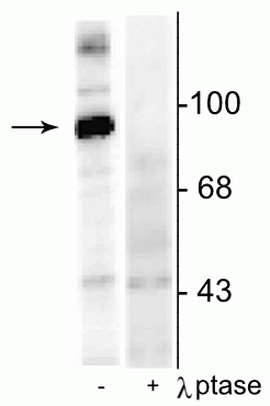 Western blot of rat hippocampal lysate stimulated with forskolin showing specific immunolabeling of the ~95 kDa dynamin phosphorylated at Ser774 in the first lane (-). Phosphospecificity is shown in the second lane (+) where immunolabeling is completely eliminated by blot treatment with lambda phosphatase (λ-Ptase, 1200 units for 30 min). 