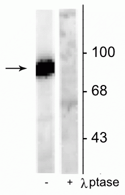 Western blot of rat hippocampal lysate stimulated with forskolin showing specific immunolabeling of the ~95 kDa dynamin phosphorylated at Ser778 in the first lane (-). Phosphospecificity is shown in the second lane (+) where immunolabeling is completely eliminated by blot treatment with lambda phosphatase (λ-Ptase, 1200 units for 30 min). 