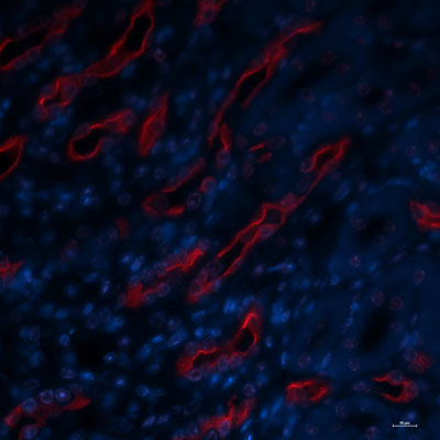 Immunolabeling of vasopressin treated mouse kidney (inner medulla) showing specific labeling of the AQP2 protein phosphorylated at Ser269 (Cat. No. p112-269, red, 1:1000). Nuclei labeled with DAPI. Magnification 10x.  Image kindly provided by Juan Pablo Arroyo Ornelas, Vanderbilt University.