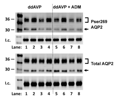 Western analysis of rat kidney inner medullary (IM) lysate from ddAVP and ddAVP + ADM-treated IM probed for total (bottom) and pSer269 (cat. p112-269, 1:1000)(top) AQP2. Brackets indicate the glycosylated AQP2 protein between 35 and 45 kDa, and the arrow indicates the un glycosylated AQP2 protein at 29 kDa. The matched pair comparisons were achieved by comparing Lane 1 with Lane 5; Lane 2 with Lane 6; Lane 3 with Lane 7; and Lane 4 with Lane 8. Image from publication CC-BY-4.0. PMID: 37047509