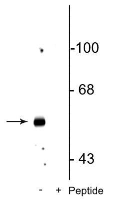 Western blot of rat hippocampal lysate showing specific immunolabeling of the ~58 kDa GABAA β3 protein phosphorylated at Ser408/409 in the first lane (-). Phosphospecificity is shown in the second lane (+) where immunolabeling is blocked by preadsorption of the phosphopeptide used as the antigen, but not by the corresponding non-phosphopeptide (not shown). 
