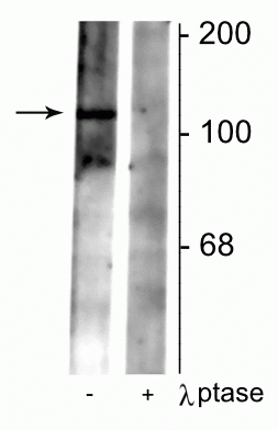 Western blot of rat synaptic membrane lysate showing specific immunolabeling of the ~102 kDa GABAB R2 protein phosphorylated at Ser783 in the first lane (-). Phosphospecificity is shown in the second lane (+) where immunolabeling is completely eliminated by blot treatment with lambda phosphatase (λ-Ptase, 1200 units for 30 min). 