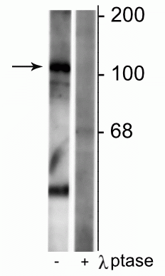 Western blot of rat synaptic membrane lysate showing specific immunolabeling of the ~102 kDa GABAB R1 protein phosphorylated at Ser923 in the first lane (-). Phosphospecificity is shown in the second lane (+) where immunolabeling is completely eliminated by blot treatment with lambda phosphatase (λ-Ptase, 1200 units for 30 min). 