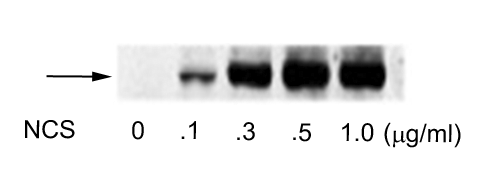 Western blot of human melanoma cells incubated with varying doses of the radiomimetic drug NCS showing specific immunolabeling of the ~74 kDa ATF2 protein phosphorylated at Ser490 and Ser498.