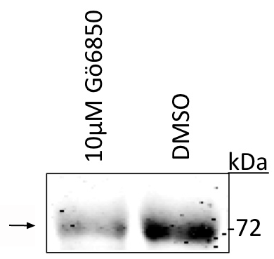 Western blot of UACC903 melanoma cell line lysate (DMSO) showing specific immunolabeling of the ~ 72 kDa ATF2 protein phosphorylated at Thr52. Immunolabeling is reduced by treatment of the lysate with the PKC catalytic inhibitor Gö6850. Image courtesy of Eric Lau and Ze’ev Ronai.