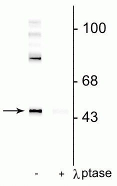 Western blot of rat cortical lysate showing specific immunolabeling of the ~50 kDa Gap-43 protein phosphorylated at Ser41 in the first lane (-). Phosphospecificity is shown in the second lane (+) where immunolabeling is completely eliminated by blot treatment with lambda phosphatase (λ-Ptase, 1200 units for 30 min). 