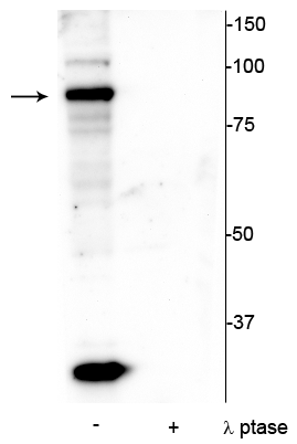 Western blot of mouse testicular lysate showing specific immunolabeling of the ~86 kDa ATRIP protein phosphorylated at Ser239 in the first lane (-). Phosphospecificity is shown in the second lane (+) where the immunolabeling is completely eliminated by lysate treatment with lambda phosphatase (λ-Ptase, 800 units/1mg protein for 30 minutes). 