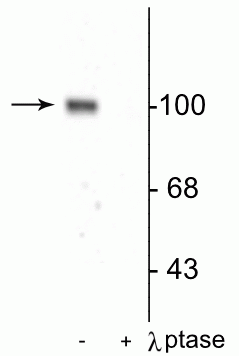 Western blot of rat hippocampal lysate showing specific immunolabeling of the ~100 kDa GluR1 protein phosphorylated at Ser845 in the first lane (-). Phosphospecificity is shown in the second lane (+) where immunolabeling is completely eliminated by blot treatment with lambda phosphatase (λ-Ptase, 1200 units for 30 min).