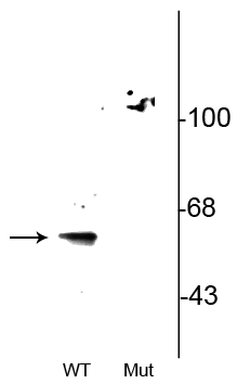 Western blot of wild type (WT) beclin-1 expressed in HeLa cell lysate showing specific immunolabeling of beclin-1 phosphorylated at Ser295. This immunolabeling is eliminated in the beclin-1 alanine substitution mutant (S295A: Mut) expressed in HeLa cell lysate. 