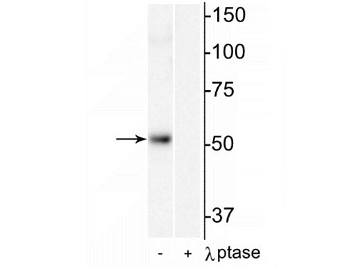 Western blot of mouse heart lysate showing specific immunolabeling of the ~55 kDa HDAC2 protein phosphorylated at Ser394 in the first lane (-). Phosphospecificity is shown in the second lane (+) where immunolabeling is completely eliminated by blot treatment with lambda phosphatase (λ-Ptase, 1200 units for 30 min).