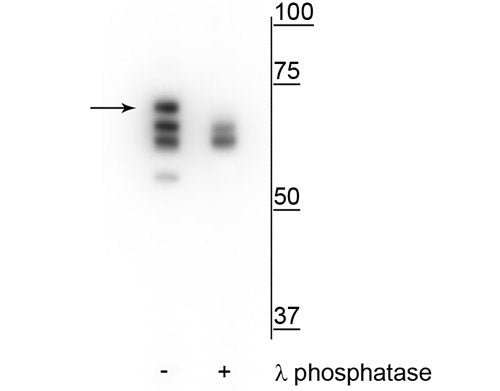 Western blot of T47D cell lysate treated with EGF (1 nM) for 60 minutes showing specific labeling of the ~70 kDa Hsp70 in the first lane (-). Phosphospecificity is shown in the second lane (+) where immunolabeling is eliminated or significantly decreased with lambda phosphatase (λ-Ptase, 1200 units for 30 minutes).