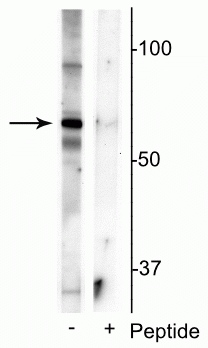 Western blot of mouse whole brain lysate showing specific immunolabeling of the ~55 kDa truncated MeCP2 protein phosphorylated at Ser421 in the first lane (-). Phosphospecificity is shown in the second lane (+) where immunolabeling is blocked by preadsorption of the phosphopeptide used as the antigen, but not by the corresponding non-phosphopeptide (not shown). 