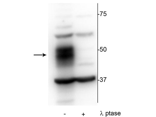 Western blot of OCIAML2 lysate showing specific immunolabeling of the ~51 kDa MEF2C phosphorylated at Ser222 in the first lane (-). Phosphospecificity is shown in the second lane (+) where the immunolabeling is completely eliminated by blot treatment with lambda phosphatase ((λ-Ptase, 1200 units for 30 minutes).