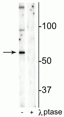 Western blot of mouse hippocampal lysate showing specific immunolabeling of the ~65 kDa Munc18-1 protein phosphorylated at Ser241 in the first lane (-). Phosphospecificity is shown in the second lane (+) where immunolabeling is completely eliminated by blot treatment with lambda phosphatase (λ-Ptase, 1200 units for 30 min).