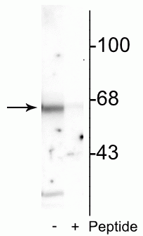 Western blot of rat cortical lysate showing specific immunolabeling of the ~65 kDa Munc-18 protein phosphorylated at Ser513 in the first lane (-). Phosphospecificity is shown in the second lane (+) where immunolabeling is blocked by preadsorption of the phosphopeptide used as the antigen, but not by the corresponding non-phosphopeptide (not shown). 